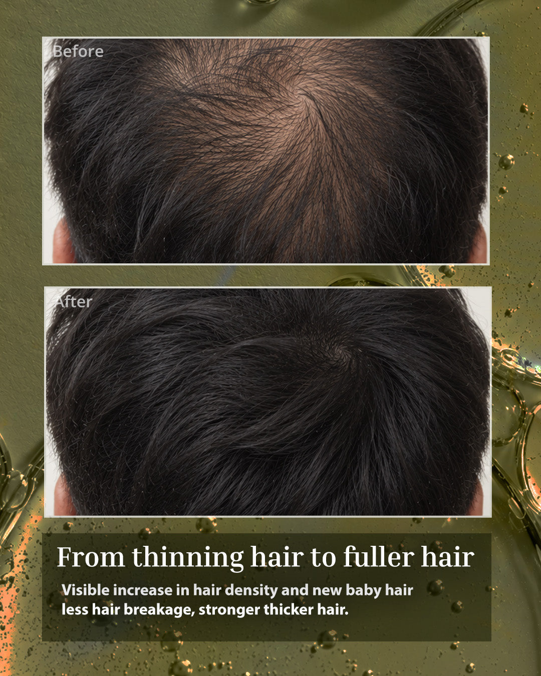 Rosemary Hair Growth Serum - Pack of 2