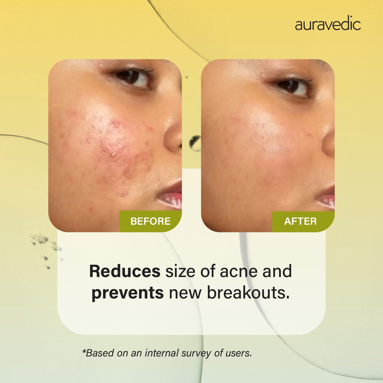 Tea Tree Serum