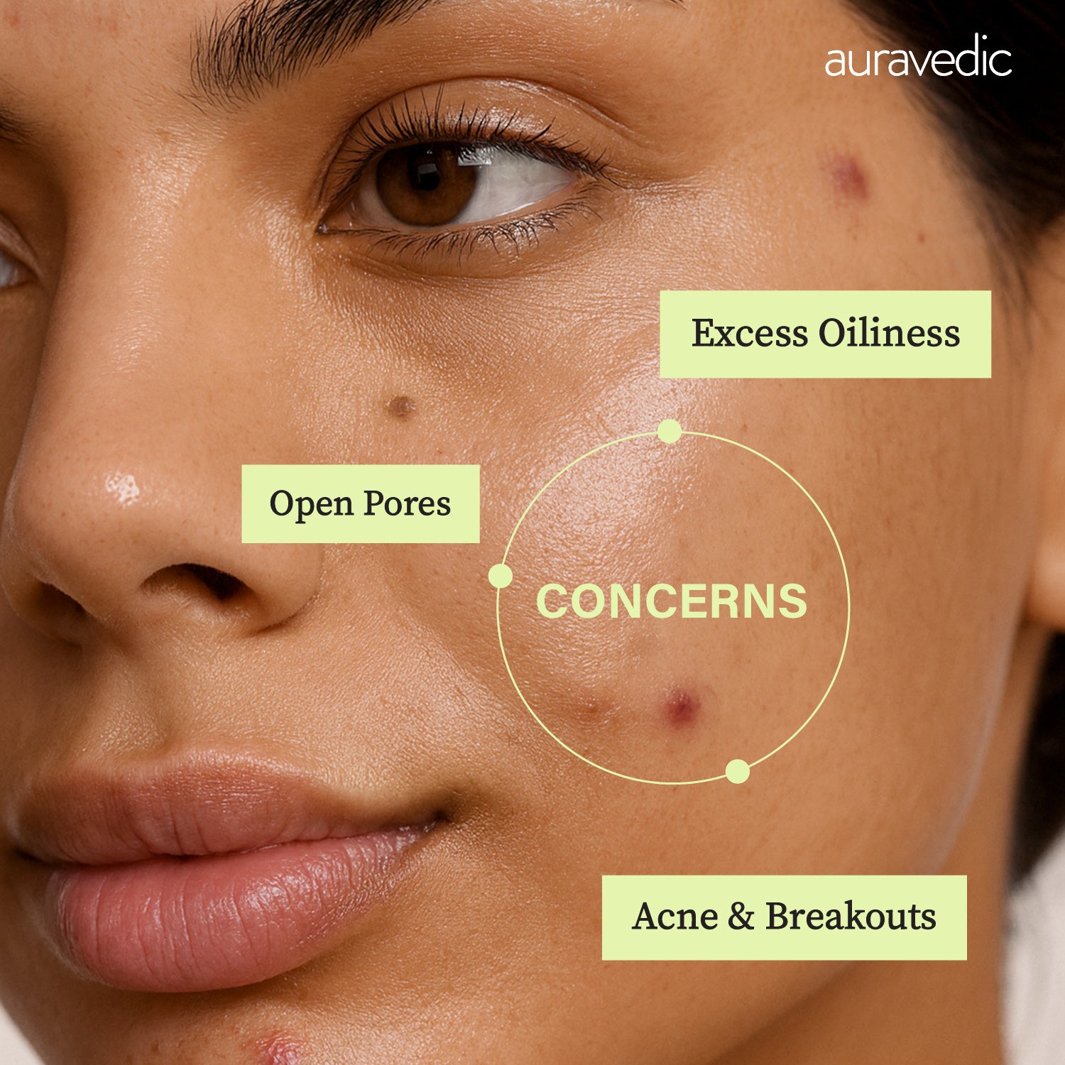 Acne Clearing Face Mask