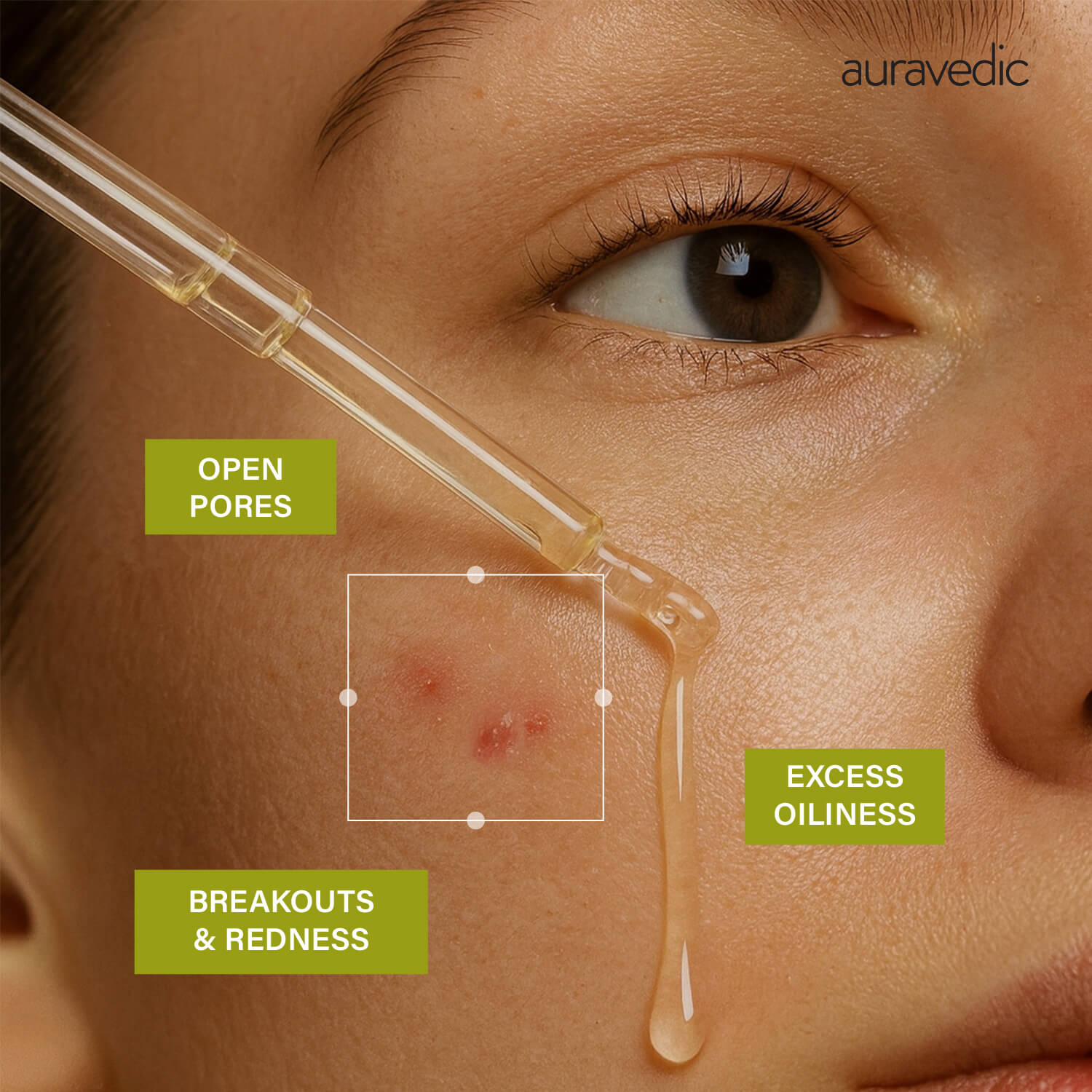 Tea Tree Serum