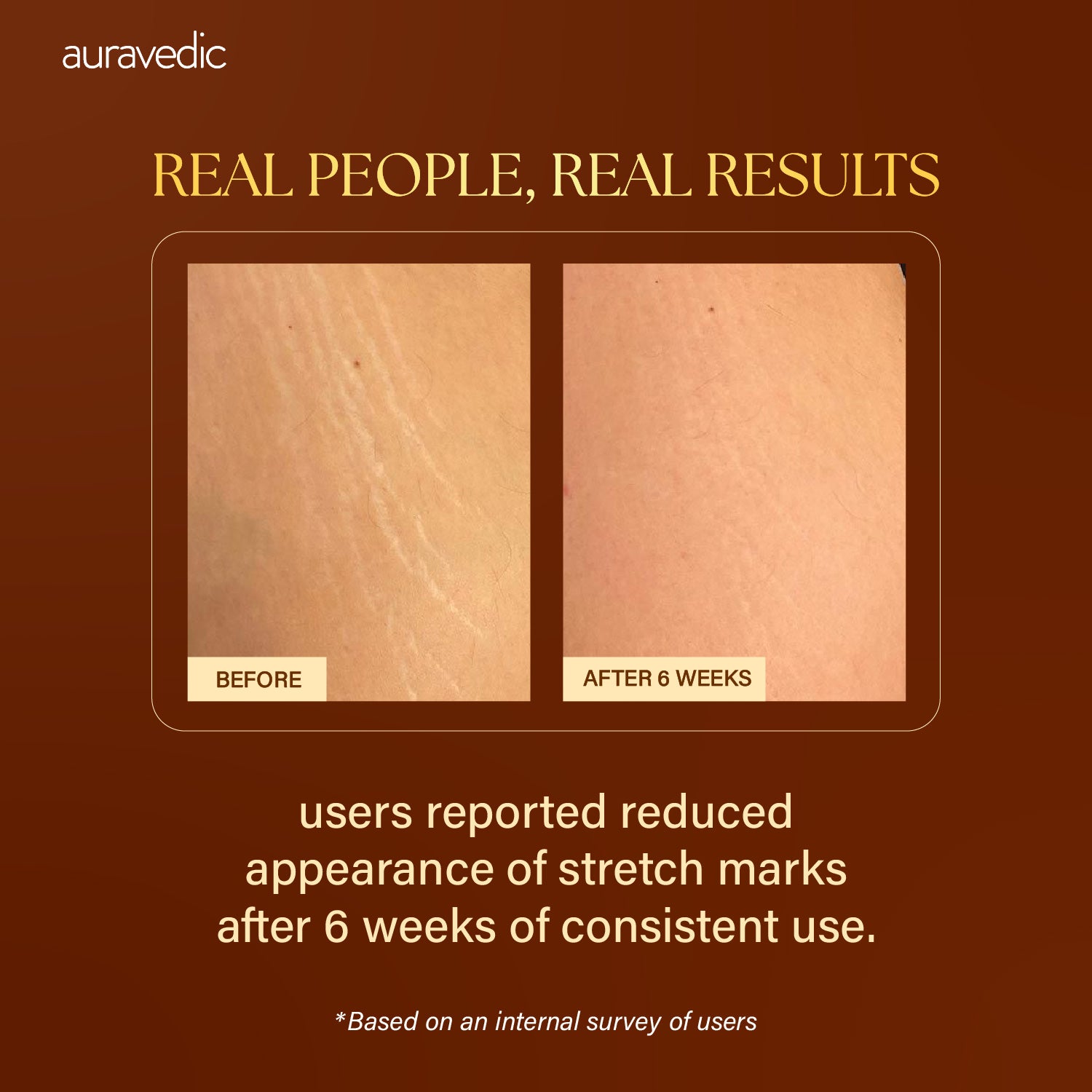 Body Toning Oil For Scars/Stretch Mark
