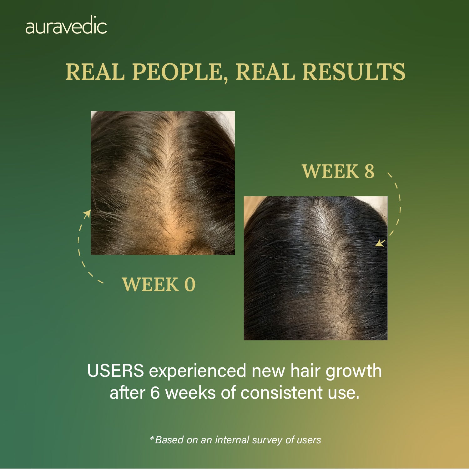The Hair Growth Serum Women Trust – Strong Roots, Fuller Hair