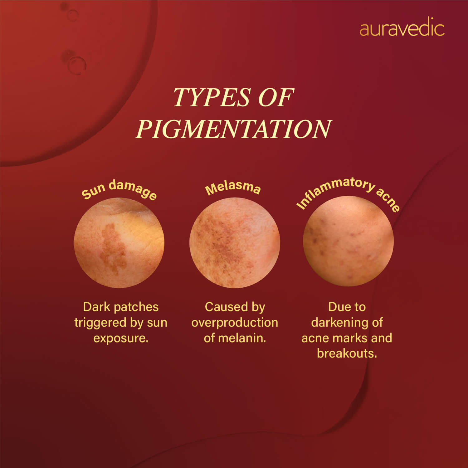 Pigmentation & Dark Spot Serum