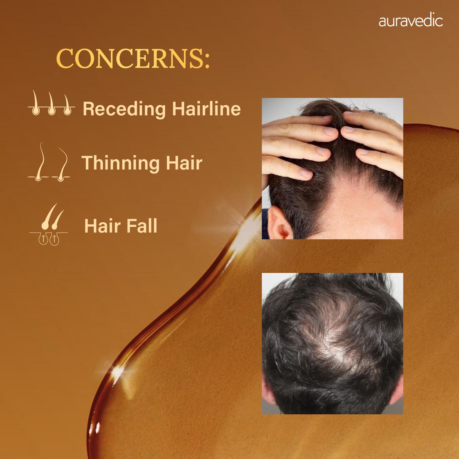 Men’s Rosemary Hair Growth Oil – Stops Hair Fall, Boosts Growth