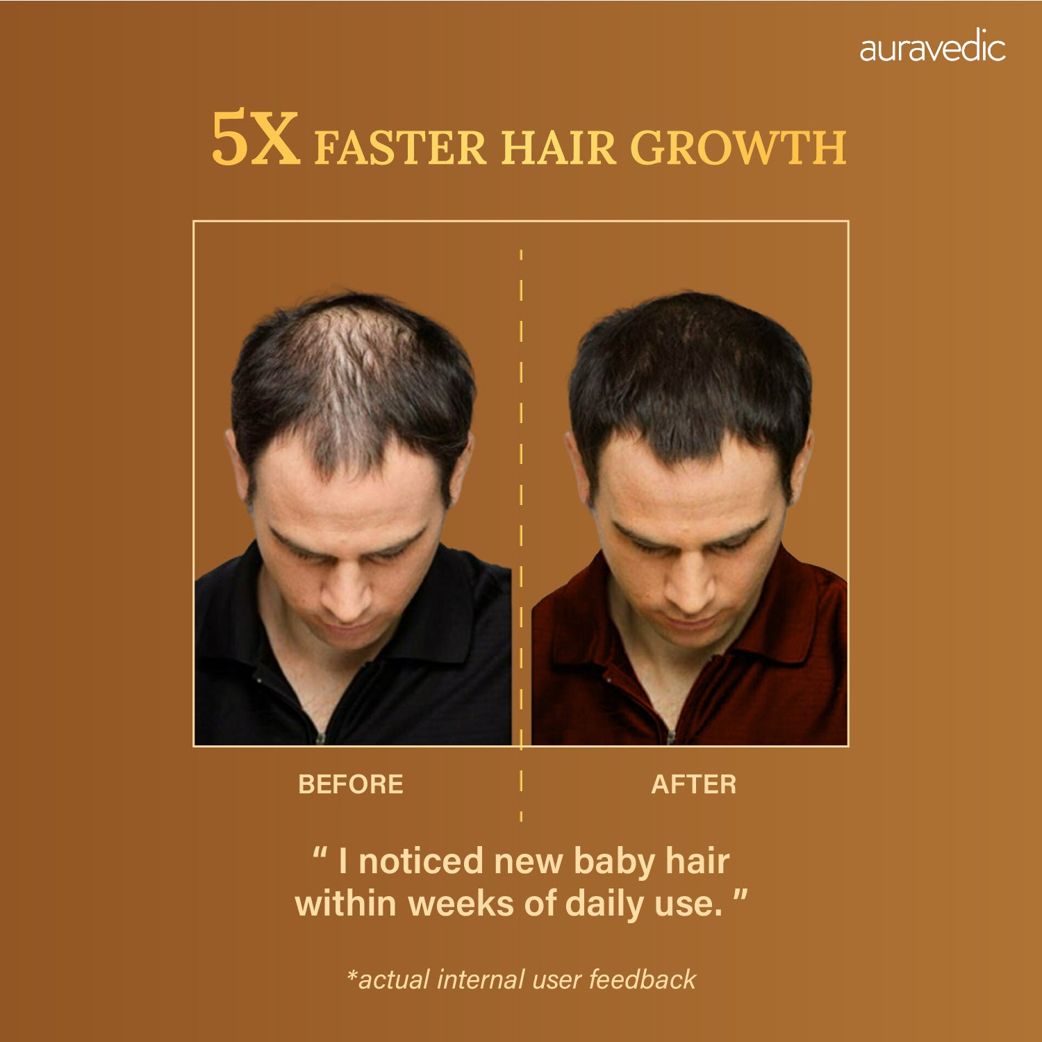 Men’s Rosemary Hair Growth Oil – Stops Hair Fall, Boosts Growth