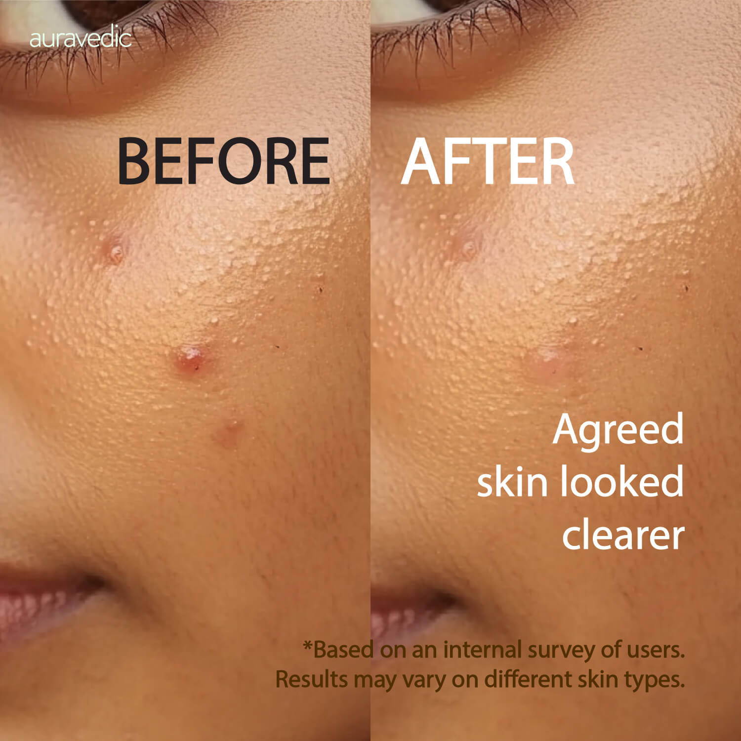 Tea Tree Face Wash
