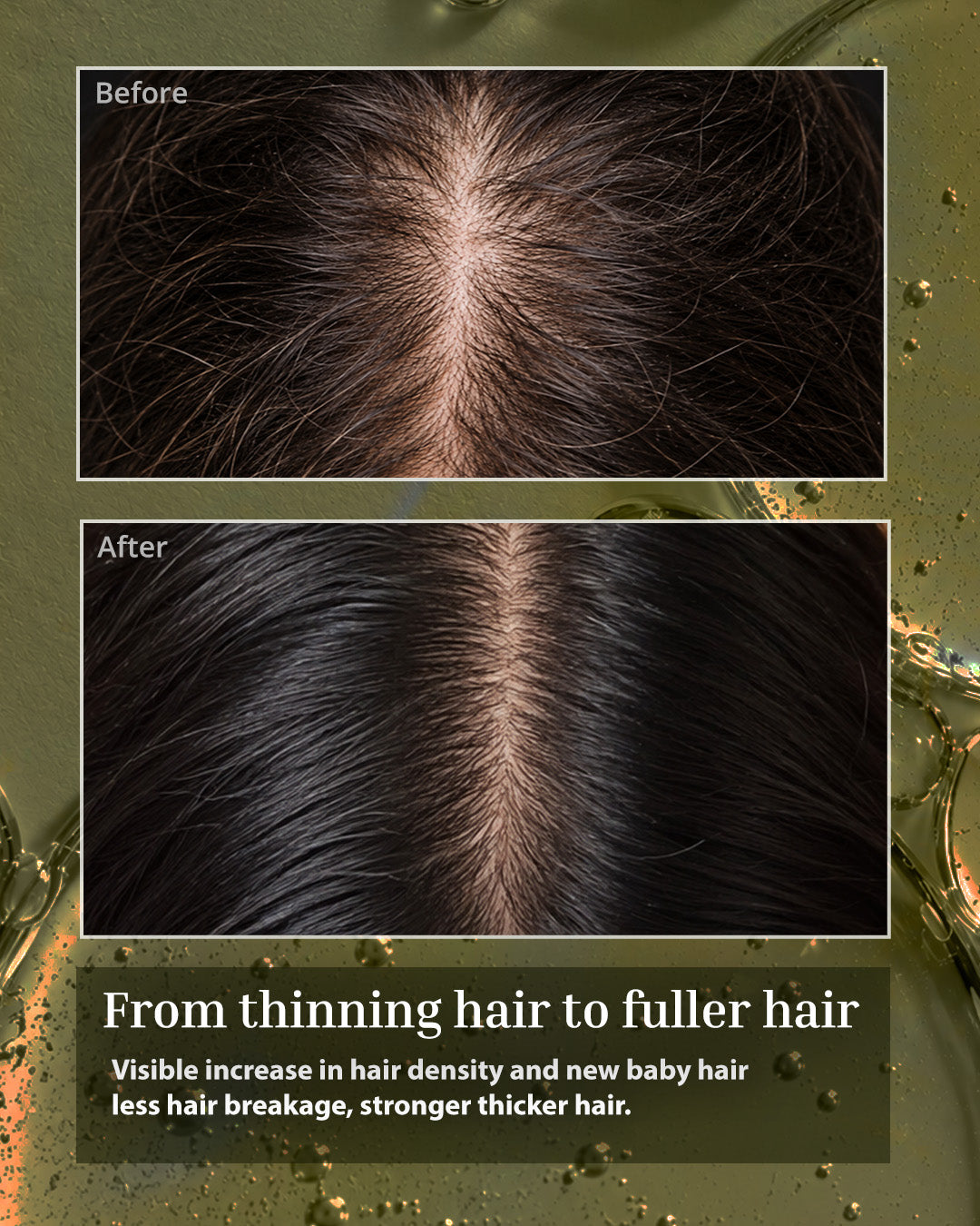 Rosemary Hair Growth Serum - Pack of 2