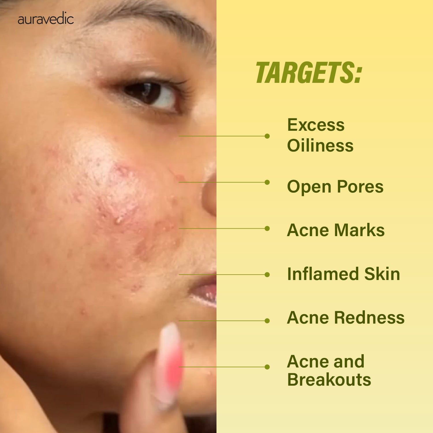 3 Step Clear Skin Solution