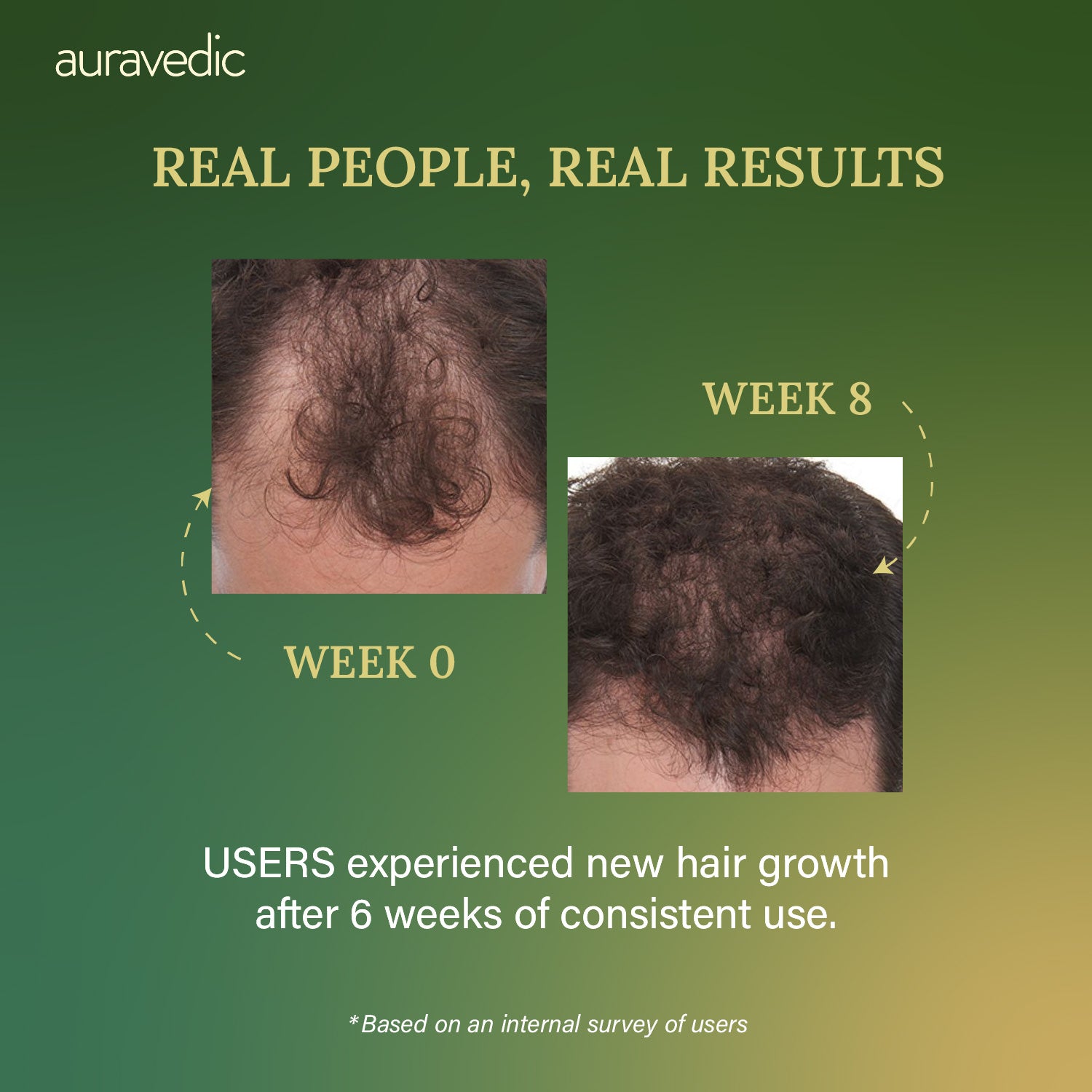 Hair Growth Serum