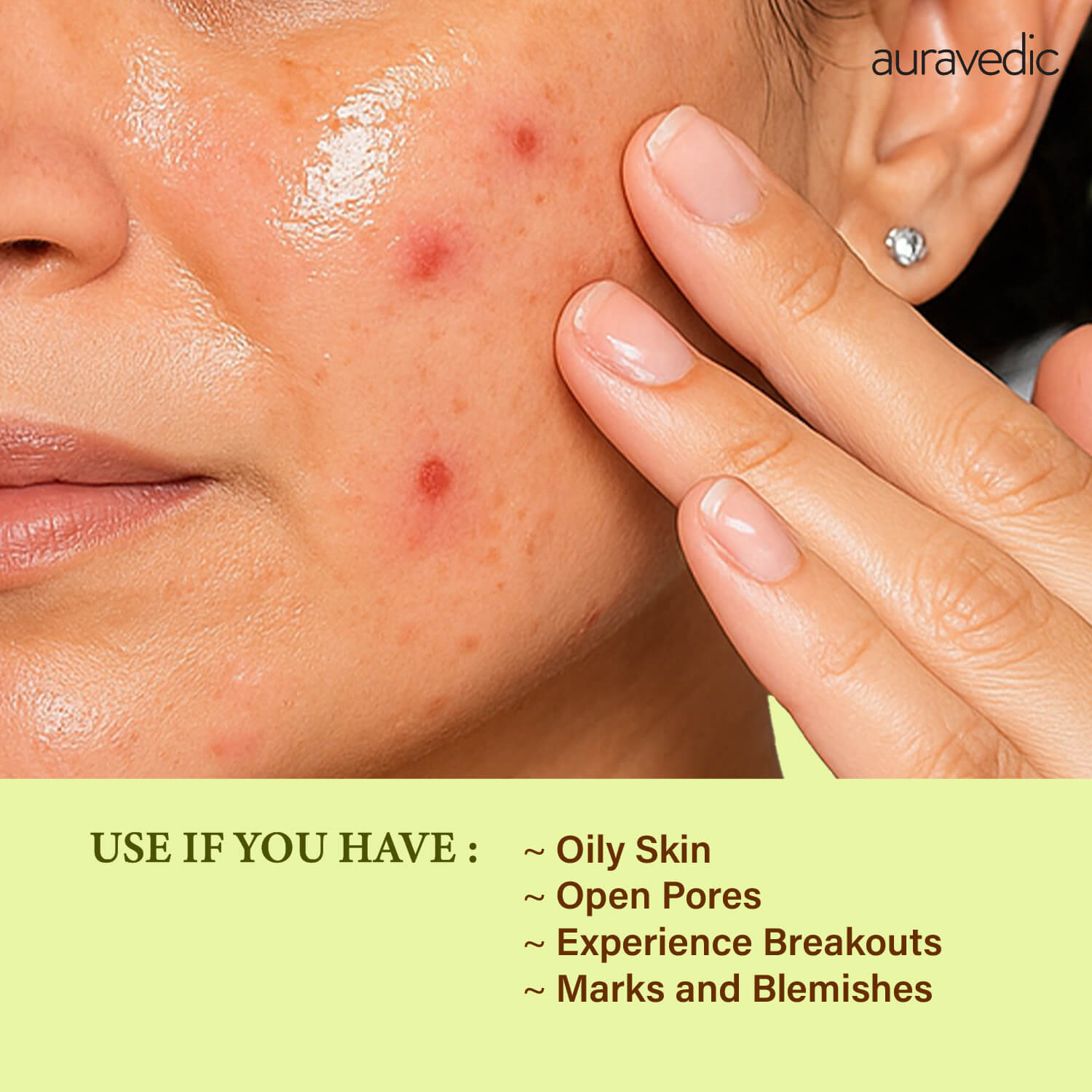 Tea Tree Face Wash & Acne Calming Sunscreen